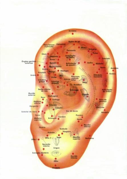 Acupuntura Auricular